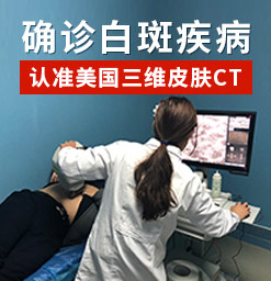 在郑州西京白癜风医院治疗儿童白斑*怎么样