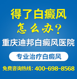 重庆有看白癜风的医院吗 白癜风一旦扩散患者怎么办