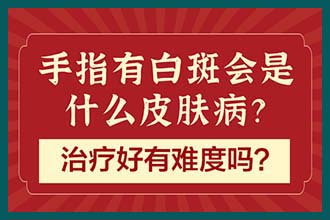 前三推荐 昆明白癜风哪家看的好