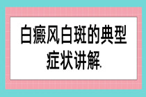 惠州 哪个医院好一点-白癜风的白斑典型症状讲解