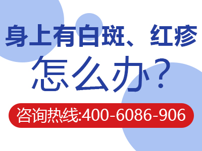 脸上总反复长白色脓点-脸上总反复长白色脓点怎么办