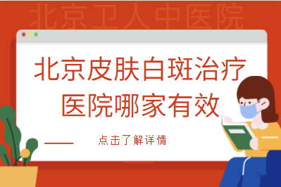 北京卫人白癜风治疗 北京白癜风应该如何正确治疗