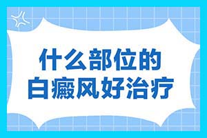 白点癫风是什么原因引起的-沈阳专治白癜风医院怎么样