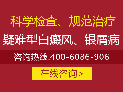 营口专业看牛皮癣医院_营口哪家医院治疗牛皮癣