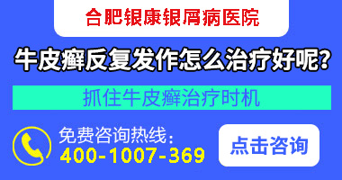 银屑病对人体的危害_银屑病对人有危害吗