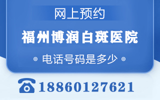 福州专业看白癜风的医院-白癜风疾病再次发作后都会出现哪些危害