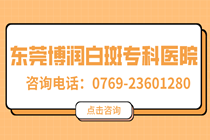 松山湖能做308激光的医院-东莞松山湖看白癜风的医院?