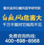 绵阳看白癜风医院那个好 白癜风患者如何避免滥用药物