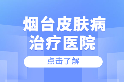 烟台专业的皮肤病医院治疗好吗-牛皮癣算是皮肤过敏吗