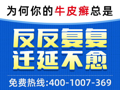 天天锻炼出汗牛皮癣为什么自愈了_每天运动能使牛皮癣自愈吗