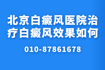 北京卫人属于什么等级的医院-醋对白斑治疗有作用吗?