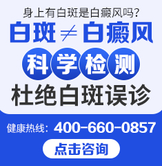 广州治疗白癜风医院有哪些-白癜风对患者有什么影响