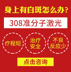 广州治疗白癜风的哪家医院好-白癜风扩散要怎么治疗