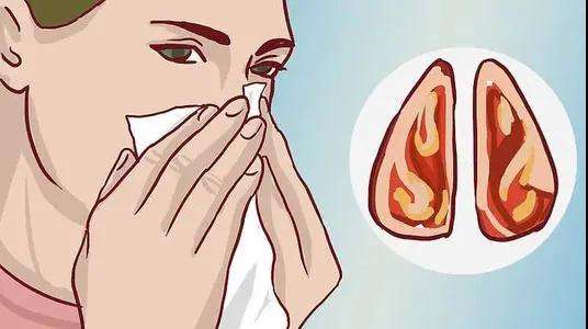 鼻甲肥大有哪些危害 首大眼耳鼻喉医院官网