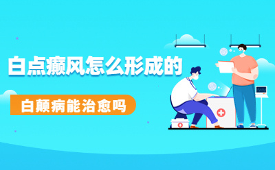 烟台到哪治疗白癜风好 白点可以擦什么药膏不会发痒