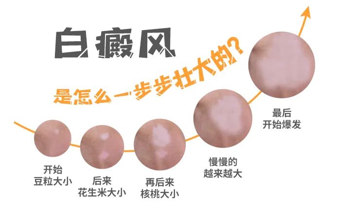 烟台半岛白癜风医院 治疗白癜风好的皮肤病医院