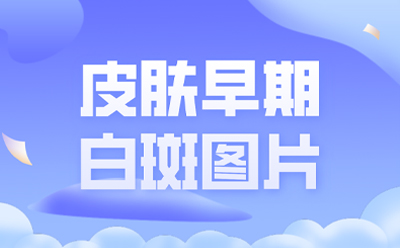 白癜风简讯  较好的白癜风医院_排名总榜实时发布 如何科学治疗呢