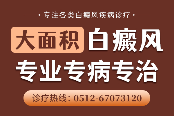 泰州白癜风医院研究所 大面积白癜风如何治疗