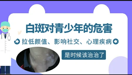 皮肤白斑去昆明白癜风医院检查-能治疗的好吗