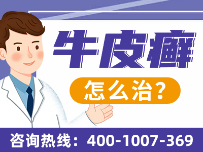 合肥银康银屑病医院厉害合肥银康银屑病_合肥银康银屑病医院是私立医院吗