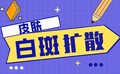 白癜风治疗前做好以下准备，恢复病情事半功倍