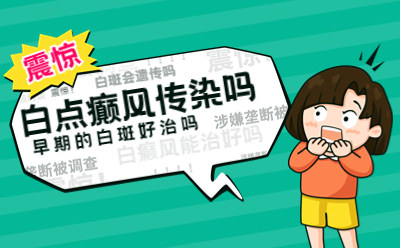 烟台白癜风专科医院好不好，白点癫风会传染吗