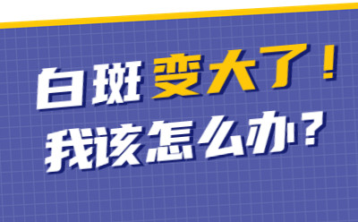 烟台白斑医院国庆能检查白癜风吗,白癜风如何预防