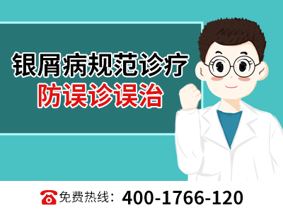 商丘治疗银屑病蕞新技术_商丘哪里可以治牛皮癣