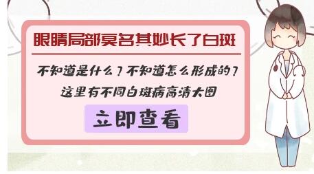 昆明专业治疗白癜风的医院 眼睛边上的皮肤发白是什么原因