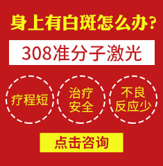 广州市治疗白癜风哪家医院好-影响白斑治疗费用的因素有哪些呢
