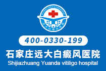 沧州看白癜风哪个医院比较好-如何护理后背的白癜风