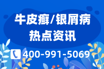 新关注：宁波博润银屑病是不是正规的？客服电话-银屑病肢端关节炎怎么治？