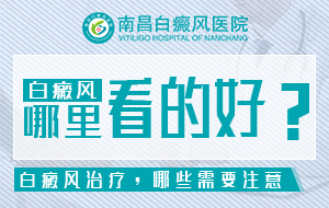 排名"TOP5"江西白癜风医院排行榜强势来袭，白癜风防复发的小方法?