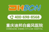 白癜风资讯!重庆看白癜风哪家医院好-青少年应该怎么预防白癜风