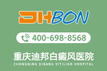 总榜发布！重庆好的白癜风治疗医院-手部白癜风有哪些症状