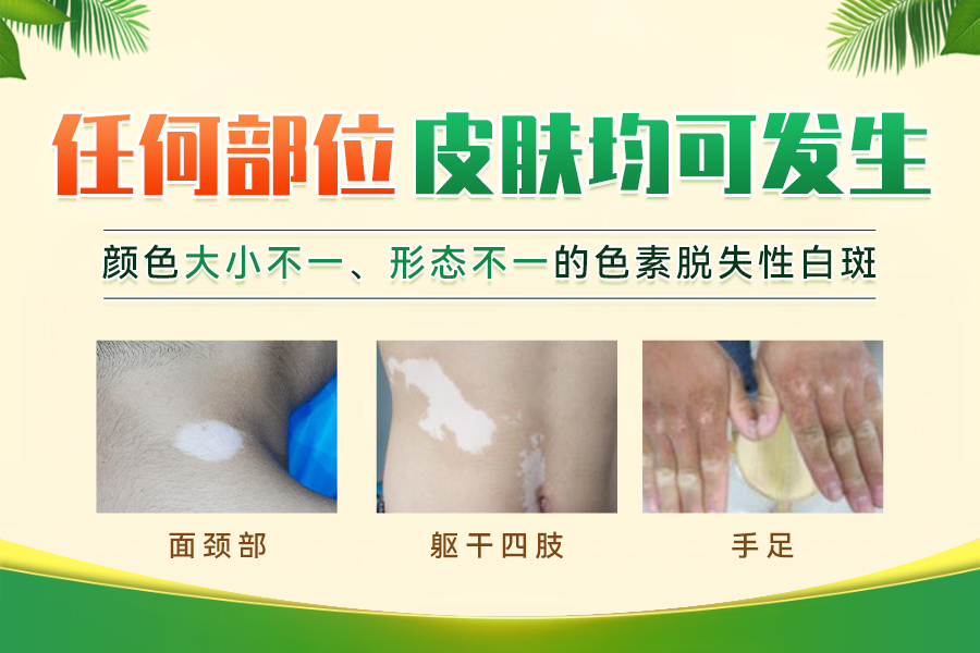医院简讯！暑期祛白专项*，北京专家来豫会诊，抢先预约专家号！
