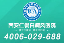 榜单公布：西安市白癜风医院“榜单揭晓”-如何根据颜色判断白癜风的严重程度？