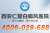 官方公布：西安仁爱白癜风医院?（服务贴心）-面部为什么容易出现白癜风?
