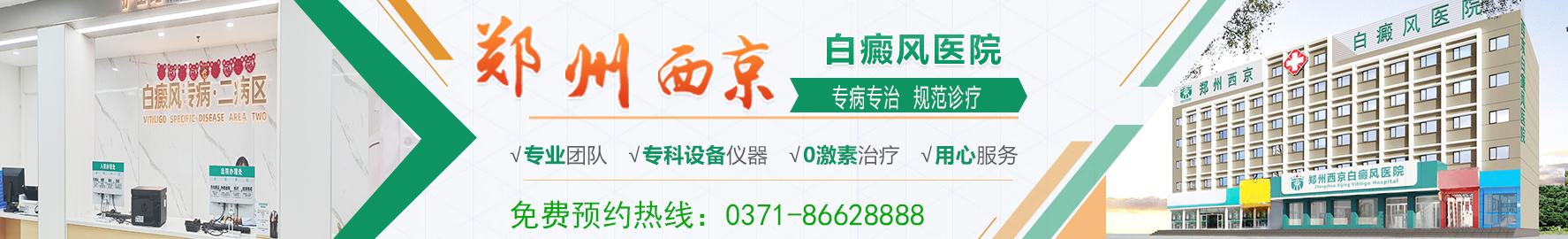 郑州西京白癜风医院