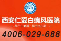 专科视角！西安治白癜风哪家医院好"多重挑战"黏膜部位白癜风治疗难点