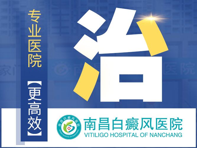 南昌哪个医院能*白癜风-新发现!南昌专业治疗白癜风医院排名宣布