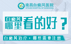 南昌治疗白癜风医院哪个好-南昌专业治疗白癜风医院推荐排名