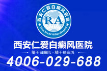 重磅发布！西安专治白癜风的医院"公告榜单"白癜风患者如何增强免疫力