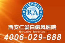 名单揭晓！西安哪家白癜风医院看得好"实力上榜"孕妇白癜风患者的饮食注意事项