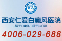 官方科普!西安哪个白癜风医院比较好"名单揭晓"白癜风皮肤会痒吗