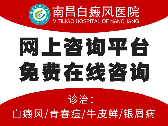 南昌哪里有医院能看白癜风-口碑排行榜：南昌白癜风专科医院“排名前三”